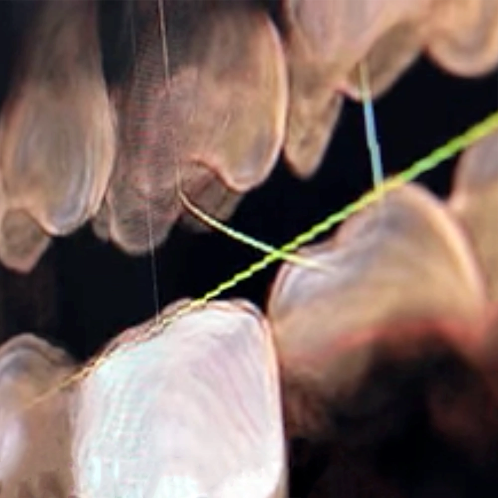 Close-up of dental X-rays showing a tooth.