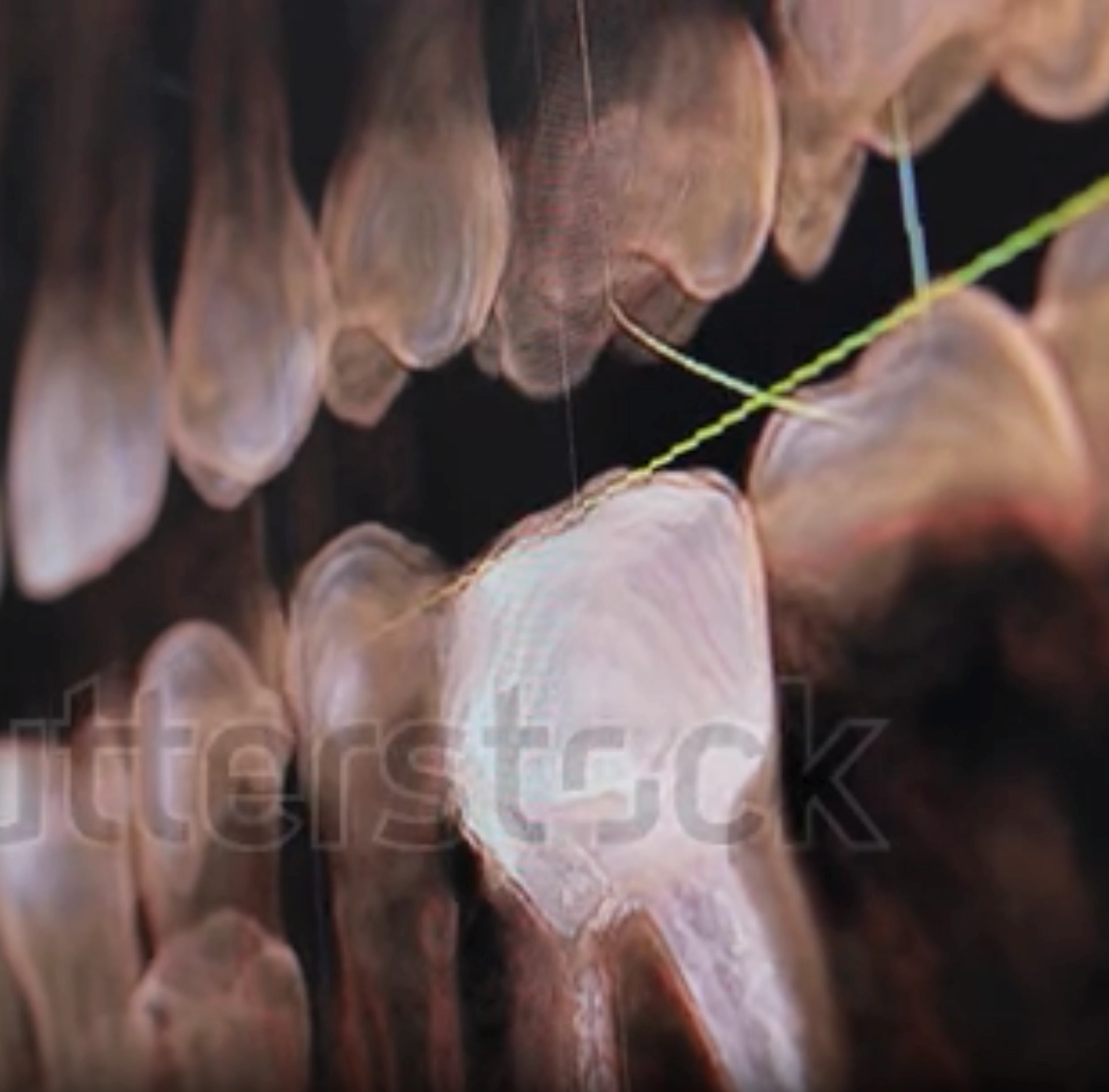 Close-up of dental X-rays showing a tooth.