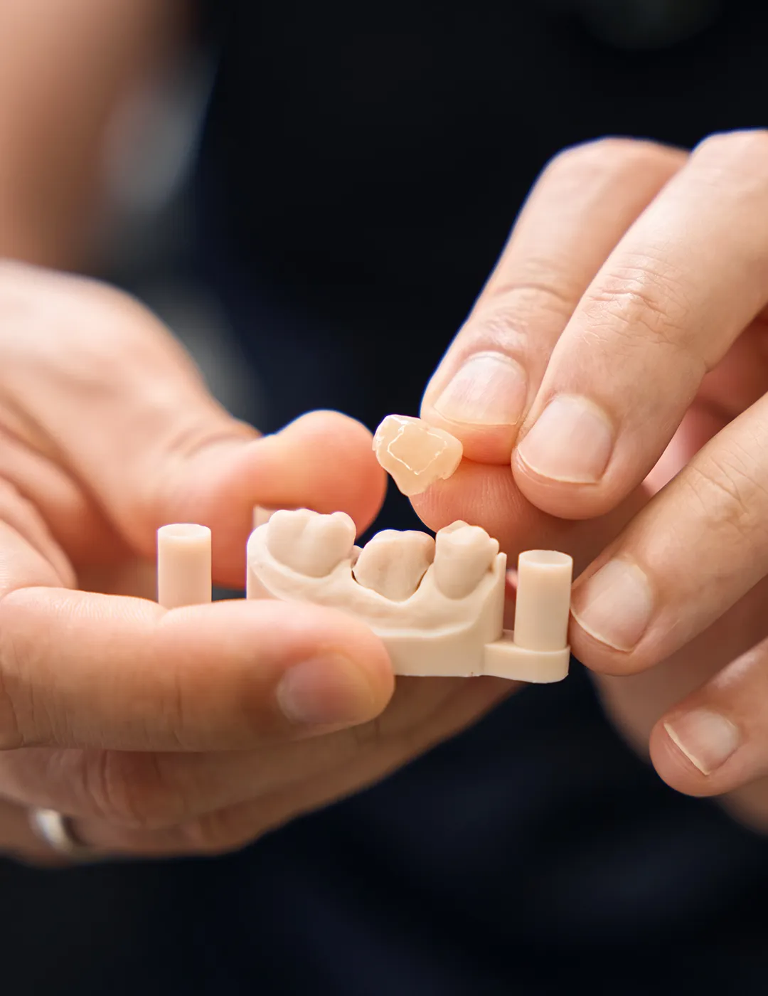 Hand using a tooth model.