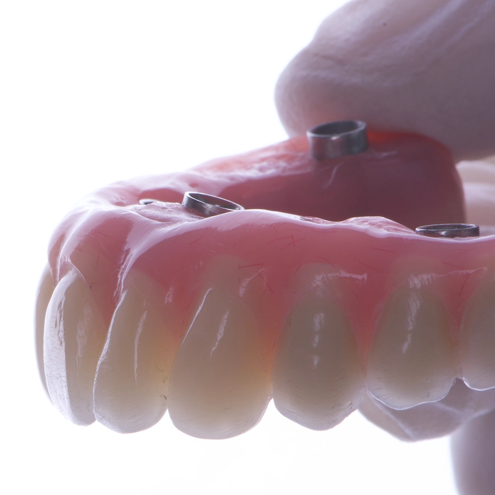 White-gloved hands holding an upper denture.