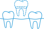 Illustration of a tooth extraction.