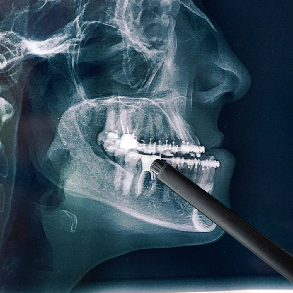 X-rays showing a mouth and teeth.