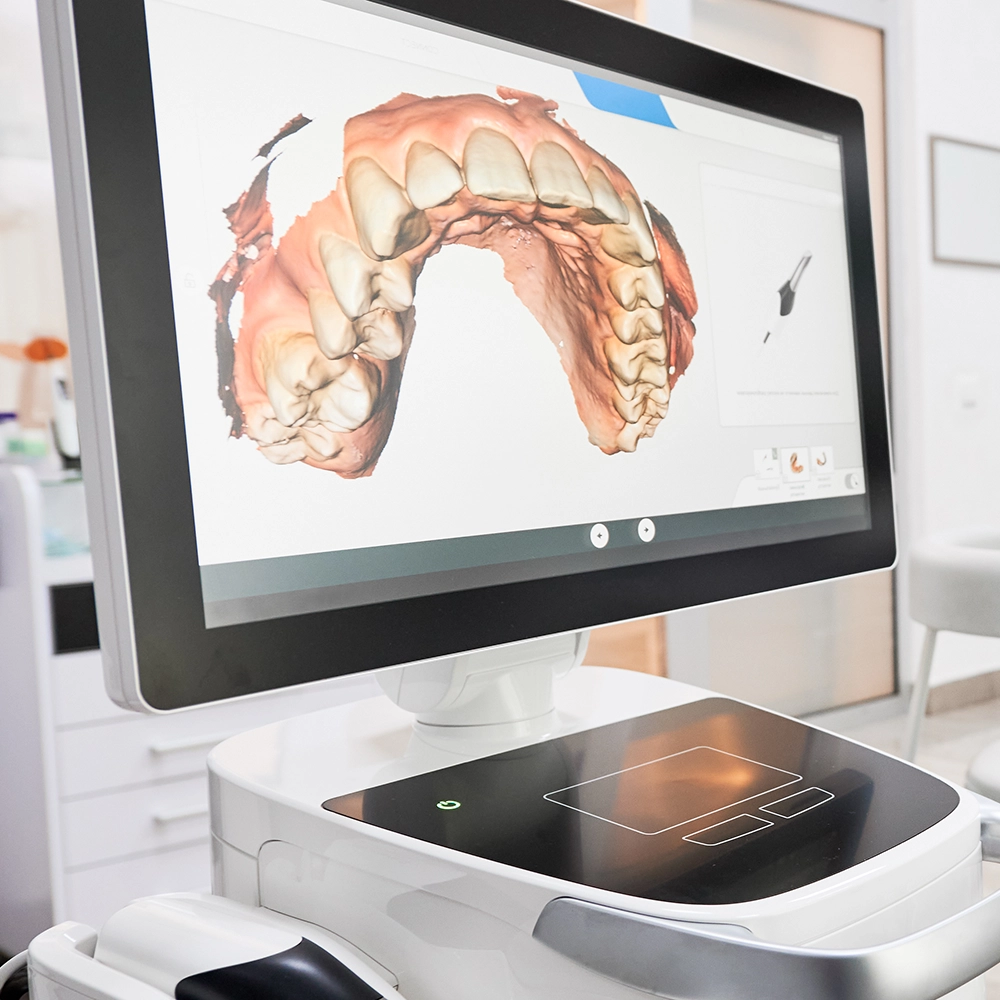 A 3d model of a upper denture displaying on a monitor.