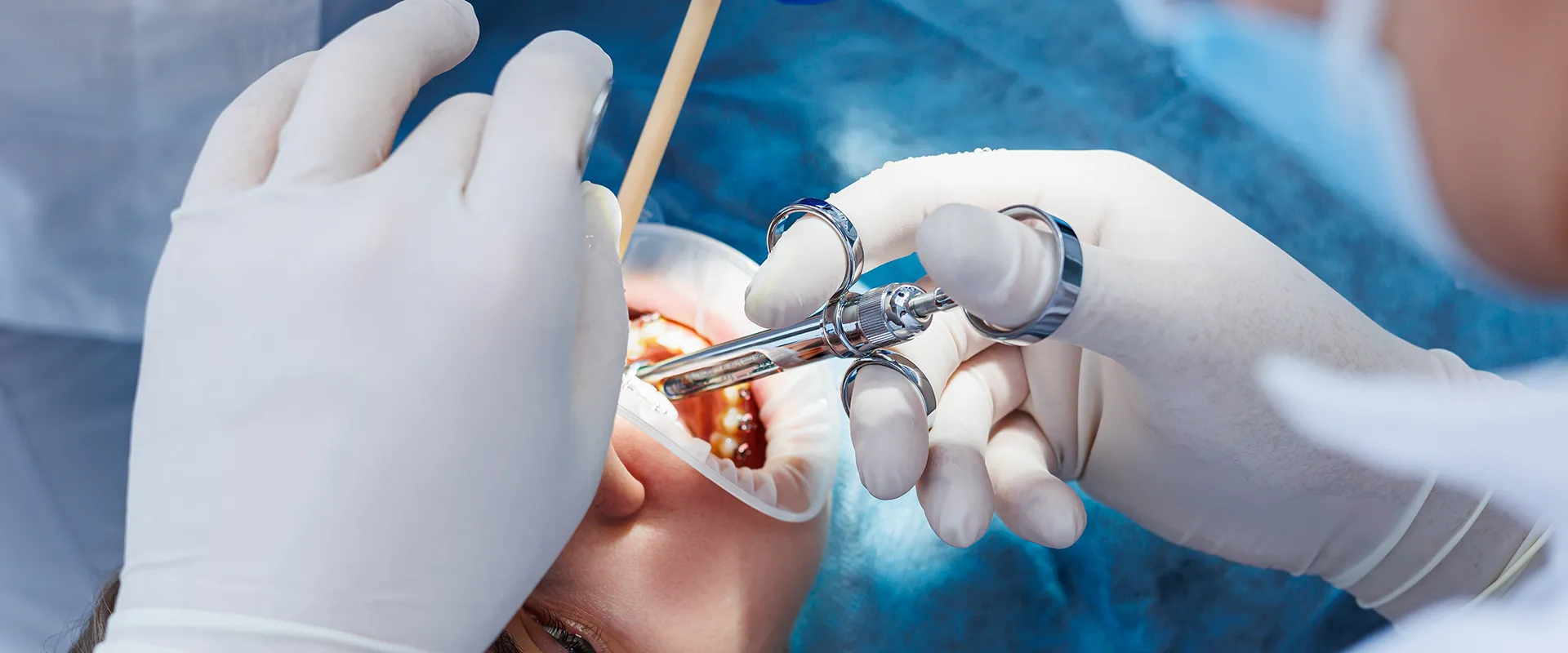 Dentist applying anesthesia to a patient's mouth.
