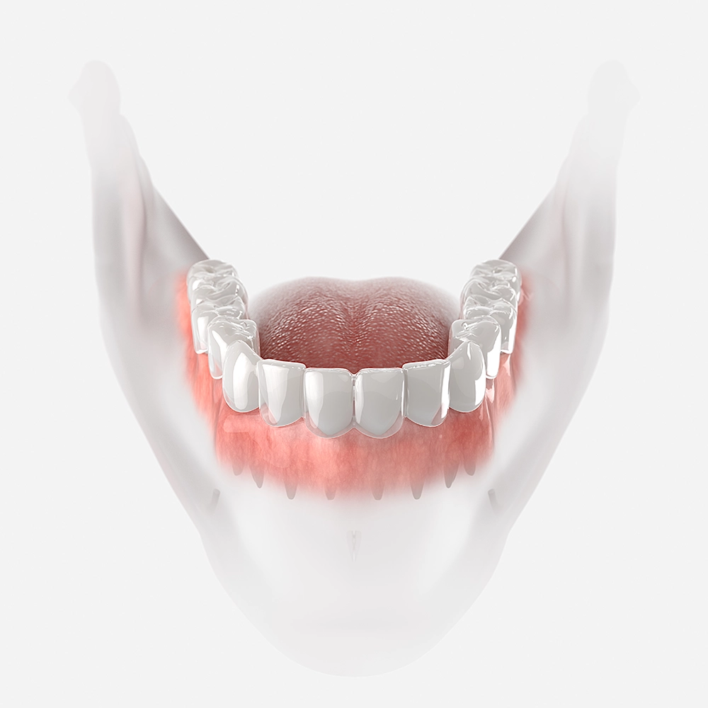 3D render of a lower denture.