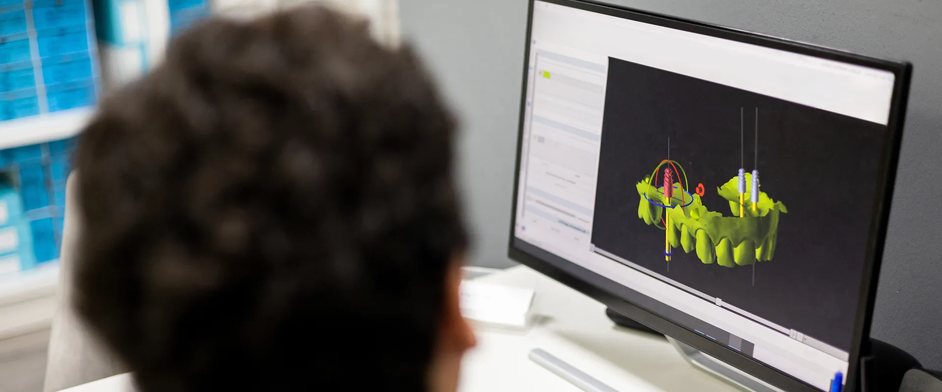 Man reviewing a 3D denture image on a computer.