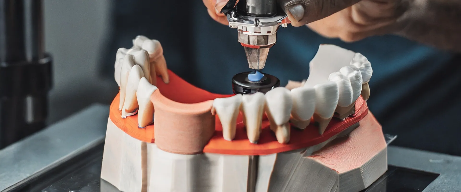 3D dental printer used for creating dental models or restorations.