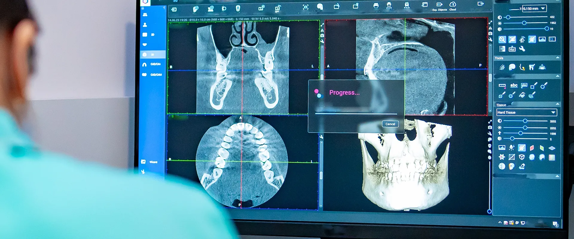 Doctor reviewing a CT scan of a patient's jaw.