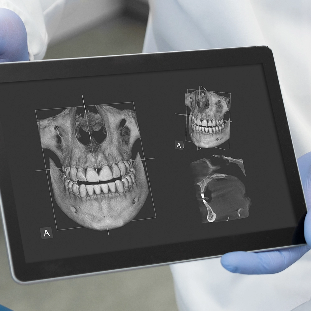 A tablet displaying x-rays.